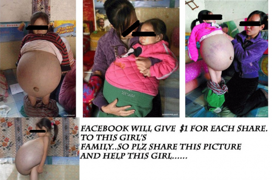 facebook-hoax-2012-girl-big-stomach